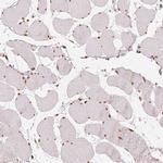 KDM5B Antibody in Immunohistochemistry (IHC)