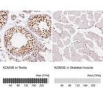 KDM5B Antibody