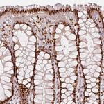 KDM5B Antibody in Immunohistochemistry (IHC)