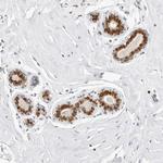 SPIDR Antibody in Immunohistochemistry (Paraffin) (IHC (P))