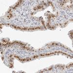 SPIDR Antibody in Immunohistochemistry (Paraffin) (IHC (P))