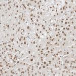 SPIDR Antibody in Immunohistochemistry (Paraffin) (IHC (P))