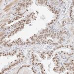 SPIDR Antibody in Immunohistochemistry (Paraffin) (IHC (P))