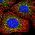 GNE Antibody in Immunocytochemistry (ICC/IF)