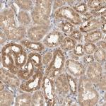 GNE Antibody in Immunohistochemistry (Paraffin) (IHC (P))