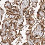 GNE Antibody in Immunohistochemistry (Paraffin) (IHC (P))