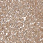 GNE Antibody in Immunohistochemistry (IHC)