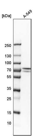 GNE Antibody in Western Blot (WB)