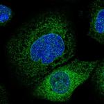 Lass2 Antibody in Immunocytochemistry (ICC/IF)