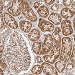 Lass2 Antibody in Immunohistochemistry (IHC)