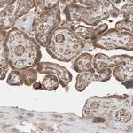 Lass2 Antibody in Immunohistochemistry (IHC)