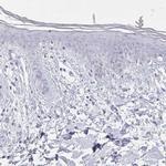 Calsequestrin 2 Antibody in Immunohistochemistry (IHC)