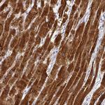 Calsequestrin 2 Antibody in Immunohistochemistry (IHC)