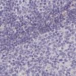 Calsequestrin 2 Antibody in Immunohistochemistry (IHC)