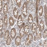 POLR3GL Antibody in Immunohistochemistry (Paraffin) (IHC (P))