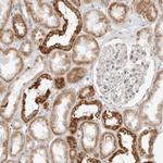 POLR3GL Antibody in Immunohistochemistry (Paraffin) (IHC (P))