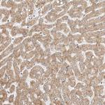 POLR3GL Antibody in Immunohistochemistry (Paraffin) (IHC (P))