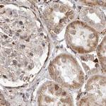 NUP43 Antibody in Immunohistochemistry (IHC)