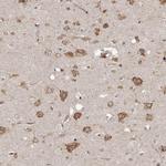 NUP43 Antibody in Immunohistochemistry (IHC)