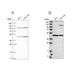 NUP43 Antibody in Western Blot (WB)