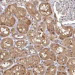 MDH1 Antibody in Immunohistochemistry (Paraffin) (IHC (P))