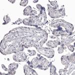 MDH1 Antibody in Immunohistochemistry (Paraffin) (IHC (P))