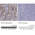 STAR Antibody in Immunohistochemistry (IHC)