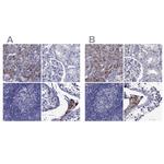 STAR Antibody in Immunohistochemistry (IHC)