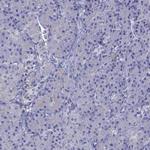 STAR Antibody in Immunohistochemistry (IHC)