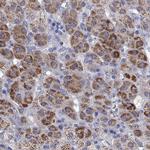 STAR Antibody in Immunohistochemistry (IHC)