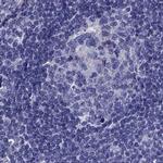 STAR Antibody in Immunohistochemistry (IHC)