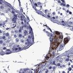 STAR Antibody in Immunohistochemistry (IHC)