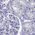 STAR Antibody in Immunohistochemistry (IHC)