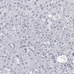 MYOC Antibody in Immunohistochemistry (Paraffin) (IHC (P))