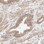 FAM150A Antibody in Immunohistochemistry (Paraffin) (IHC (P))