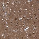 GAK Antibody in Immunohistochemistry (Paraffin) (IHC (P))