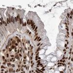 PPP1R8 Antibody in Immunohistochemistry (IHC)