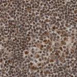 PPP1R8 Antibody in Immunohistochemistry (IHC)