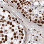 PPP1R8 Antibody in Immunohistochemistry (IHC)