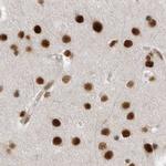 PPP1R8 Antibody in Immunohistochemistry (IHC)