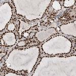 PPP1R8 Antibody in Immunohistochemistry (IHC)