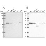 PPP1R8 Antibody in Western Blot (WB)