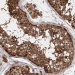 STK36 Antibody in Immunohistochemistry (IHC)