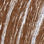 ZCCHC11 Antibody in Immunohistochemistry (Paraffin) (IHC (P))