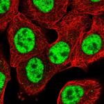 PPP1R8 Antibody in Immunocytochemistry (ICC/IF)