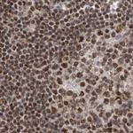 PPP1R8 Antibody in Immunohistochemistry (IHC)