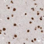 PPP1R8 Antibody in Immunohistochemistry (IHC)