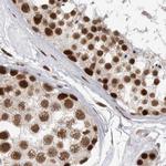 PPP1R8 Antibody in Immunohistochemistry (IHC)