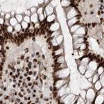 PPP1R8 Antibody in Immunohistochemistry (IHC)