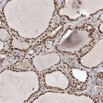 PPP1R8 Antibody in Immunohistochemistry (IHC)